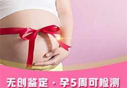 曲靖怀孕了怎么做DNA鉴定，曲靖孕期亲子鉴定基本流程